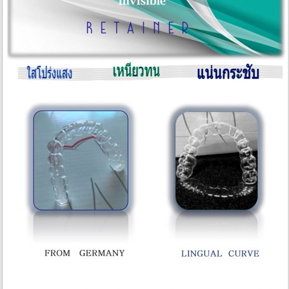 Fixings Invisible Rtn Germany