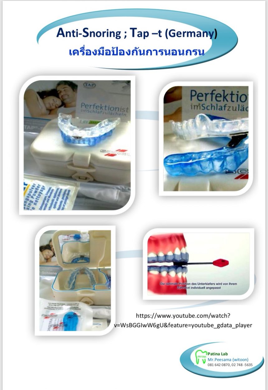 เครื่องมือป้องกัน การนอนกรน Tap-T ของ Scheu ประเทศ เยอรมัน เครื่องมือป้องกัน การนอนกรน Tap-T ของ Scheu ประเทศ เยอรมัน