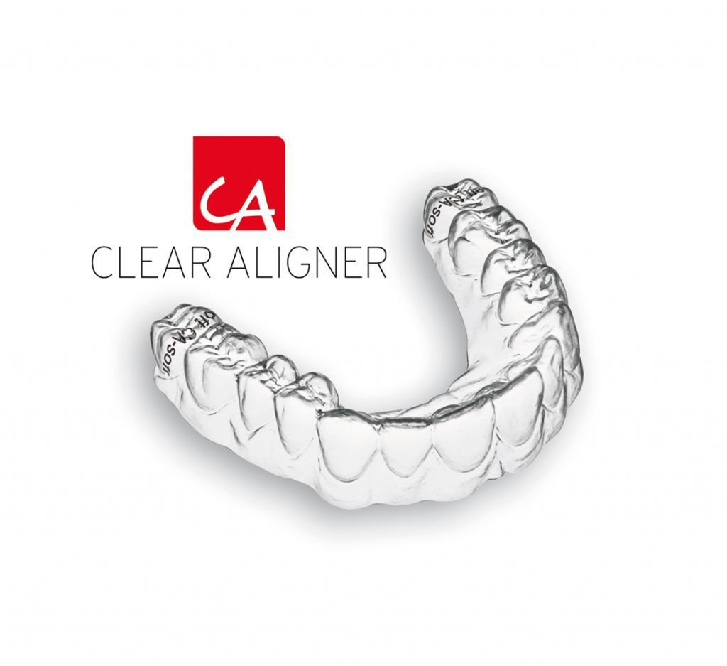 Clear Aligner - Patina Dental Lab