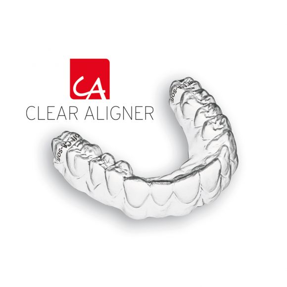 Clear Aligner