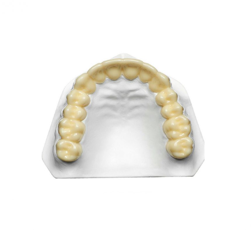 Esthic Whitening Retainer Esthic Whitening Retainer