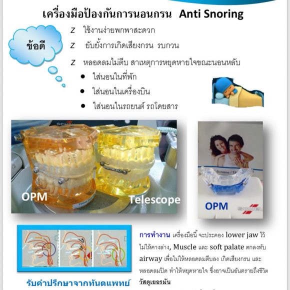 Anti-Snoring