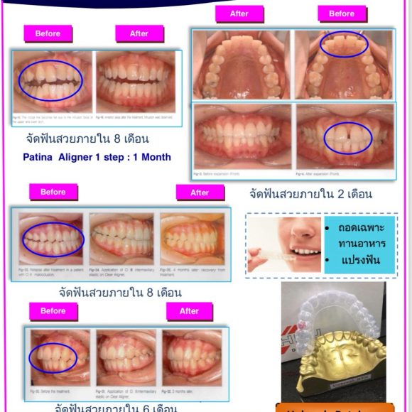Program Scan ; CA Scheu Germany