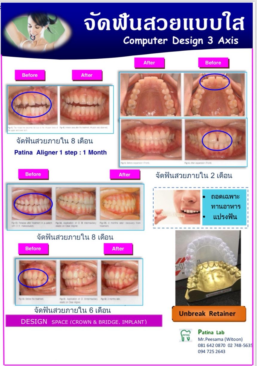 Program Scan ; CA Scheu Germany