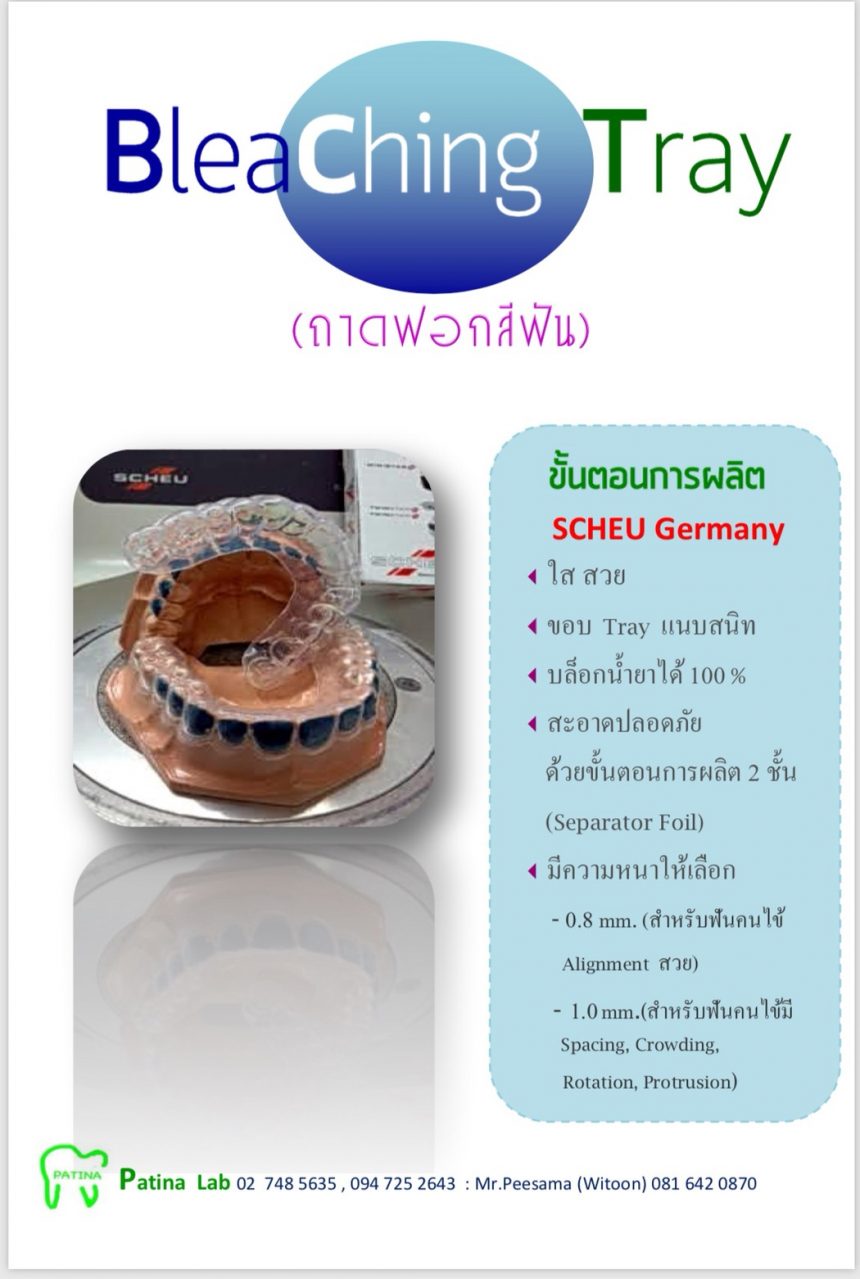 Bleaching Tray Bleaching Tray